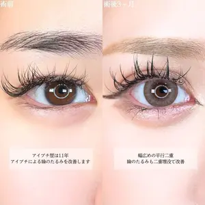 アリエル美容クリニック 大宮院 鈴木　桂介医師の症例