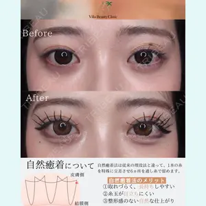 小倉美容外科/美容皮膚科 ビラビューティークリニック 大村 亞蘭医師の症例