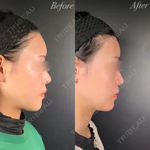 R Beauty CLINIC 銀座院 吉田　慧医師の症例
