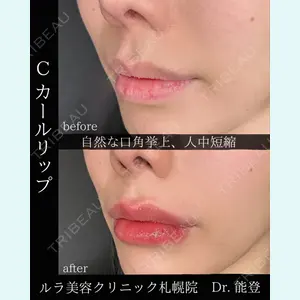 ルラ美容クリニック 札幌院 能登 貴弘医師の症例