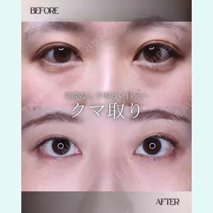 小倉美容外科/美容皮膚科 ビラビューティークリニック 大村 亞蘭医師の症例