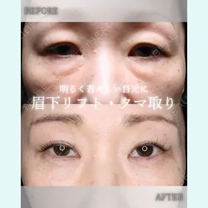 小倉美容外科/美容皮膚科 ビラビューティークリニック 大村 亞蘭医師の症例