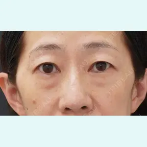 症例