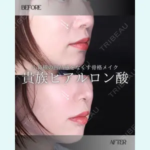 小倉美容外科/美容皮膚科 ビラビューティークリニック 大村 亞蘭医師の症例