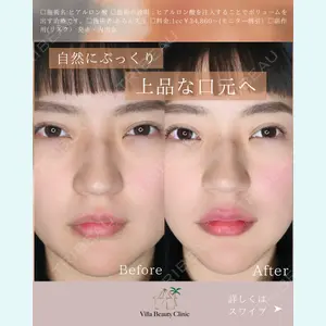 小倉美容外科/美容皮膚科 ビラビューティークリニック 大村 亞蘭医師の症例
