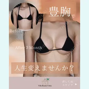 小倉美容外科/美容皮膚科 ビラビューティークリニック 大村 亞蘭医師の症例