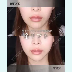 小倉美容外科/美容皮膚科 ビラビューティークリニック 大村 亞蘭医師の症例