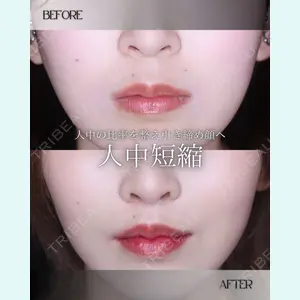 小倉美容外科/美容皮膚科 ビラビューティークリニック 大村 亞蘭医師の症例