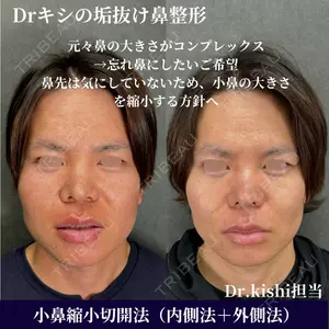 ネビュラクリニック 京都院 岸 大輔医師の症例