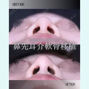 小倉美容外科/美容皮膚科 ビラビューティークリニック 大村 亞蘭医師の症例