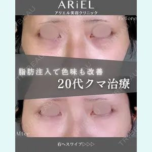 アリエル美容クリニック 郡山院 安齋 誠基医師の症例