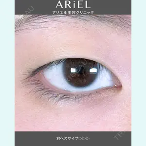 アリエル美容クリニック 郡山院 安齋 誠基医師の症例