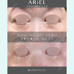 アリエル美容クリニック 郡山院 安齋 誠基医師の症例