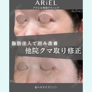 アリエル美容クリニック 郡山院 安齋 誠基医師の症例