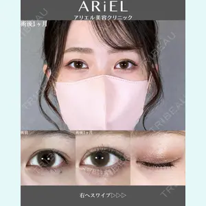 アリエル美容クリニック 郡山院 安齋 誠基医師の症例
