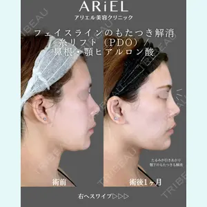 アリエル美容クリニック 郡山院 安齋 誠基医師の症例