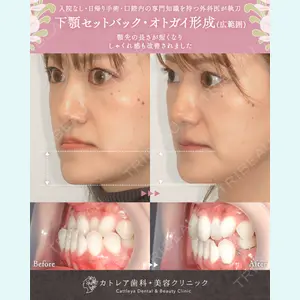 カトレア歯科・美容クリニック 辻 和志医師の症例