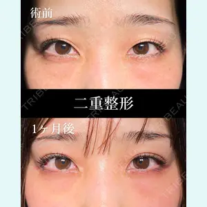 症例