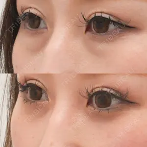 症例