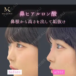 MKクリニック 日本橋院 石田雄太郎医師の症例