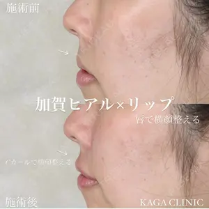 KAGA CLINIC 加賀 裕基医師の症例