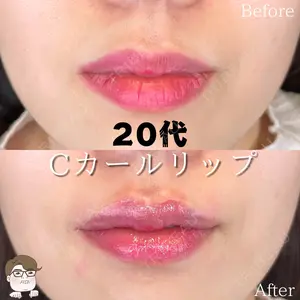 ルラ美容クリニック 札幌院 佐藤 雄紀医師の症例