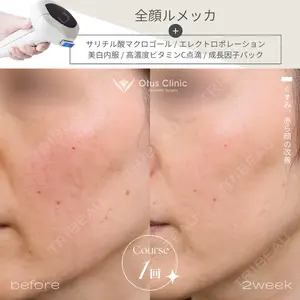 Otus Clinic 【オータスクリニック】 中 徳太郎医師の症例