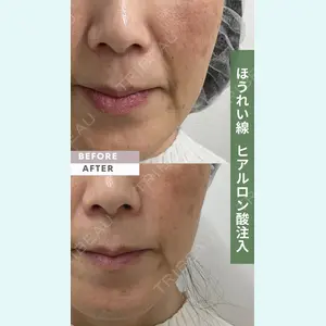 ゆう美容クリニックの症例