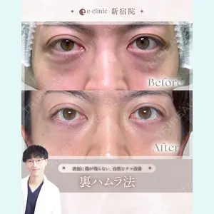 症例