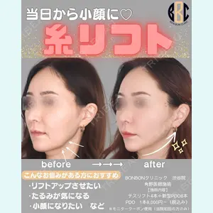 症例