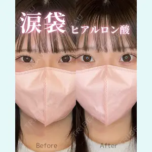 症例
