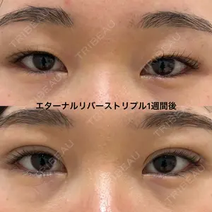エターナル美容クリニック 久門田 詳医師の症例