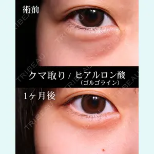 症例