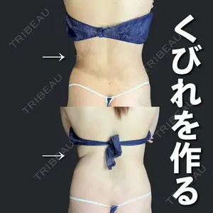 AVAN TOKYO 銀座脂肪吸引 クリニック 森脇 進医師の症例