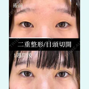 症例