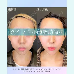 ルラ美容クリニック 札幌院 佐藤 雄紀医師の症例