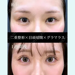 症例