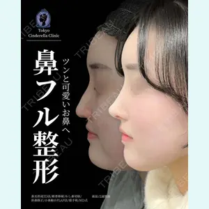 東京シンデレラ美容外科 新宿院 吉原 伯医師の症例