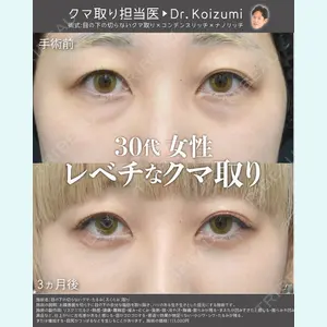 症例