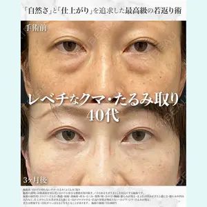 症例
