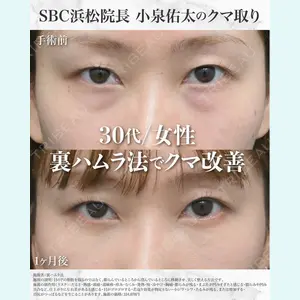症例