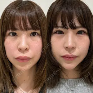 エターナル美容クリニック 久門田 詳医師の症例