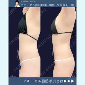 東京シンデレラ美容外科 新宿院 吉原 伯医師の症例