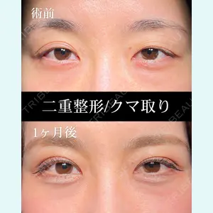 症例
