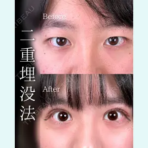 症例