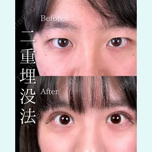 症例