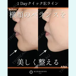東京形成美容外科 船橋院 山田 大輔医師の症例