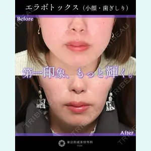 症例