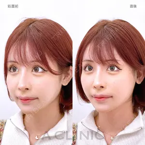 症例