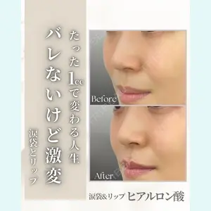 APスキンクリニック銀座 高麗 惠理医師の症例